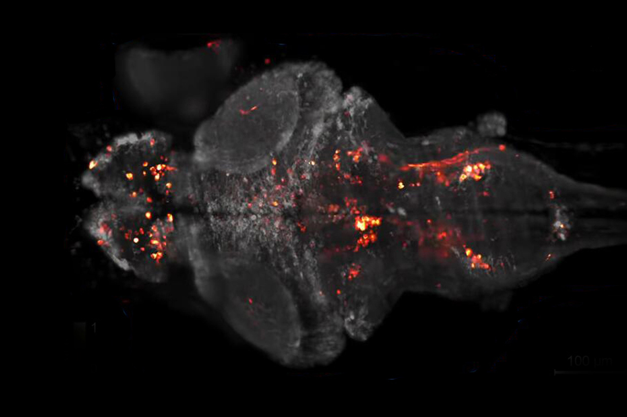 1-6 钙离子成像Calcium-imaging