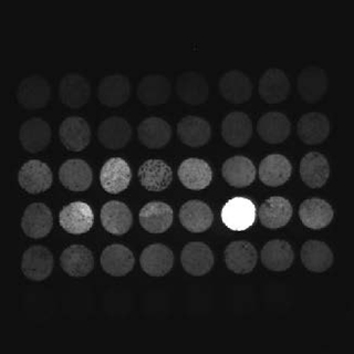 qPCR